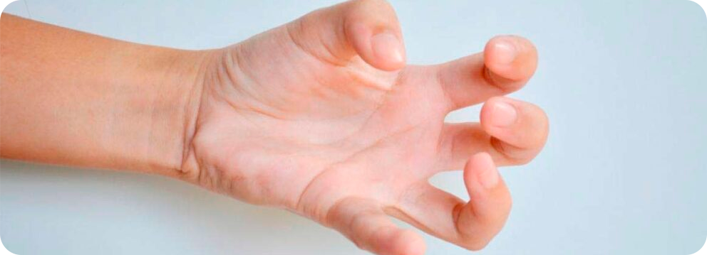 Distonia: diagnóstico e opções de tratamento com neurologista